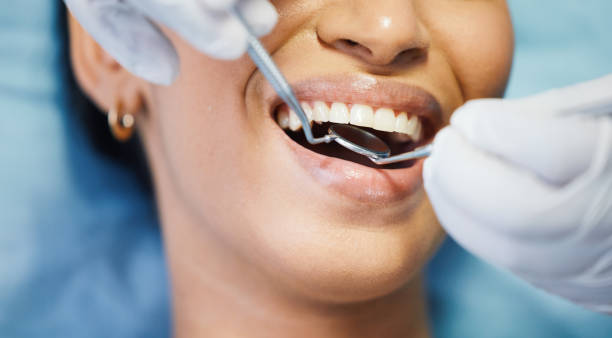 Best Emergency Dental Care for Sports Injuries in Eagle Lake, FL